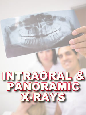 Intraoral & Panaoramic X-Rays